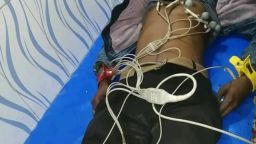 হরিণাকুণ্ডুতে মোটরসাইকেল ইজিবাইক সংঘর্ষে একজন নিহত