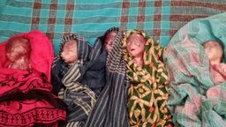 একসঙ্গে জন্ম নিল ৫ শিশু, ক্ষণিকের ব্যবধানেই সব শেষ !