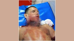 কাশিয়ানীতে পূর্ব শত্রুতার জেরে মসজিদের ইমামকে কুপিয়ে জখম