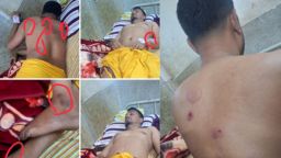 গোপালগঞ্জে কাপড় ব্যবসায়ীর ওপর সন্ত্রাসী হামলা, নগদ অর্থসহ কয়েক লক্ষ টাকার মালামাল লুটের অভিযোগ