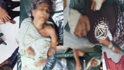 ফুলগাজীতে ঘরে ঢুকে মা-ছেলেসহ তিনজনকে কুপিয়ে জখম