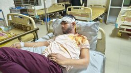 টুঙ্গিপাড়ায় বিএনপি কর্মীকে কুপিয়ে জখমের অভিযোগ জামায়াত কর্মীর বিরুদ্ধে