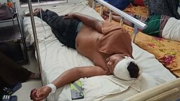 চাটখিলে বড় ভাইয়ের কোপে ছোট ভাই গুরুতর জখম