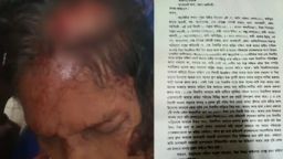 মনোহরদীতে জমি সংক্রান্ত বিরোধের জেরে হামলার শিকার এক নারী!