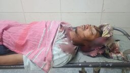 গোপালগঞ্জে মোটরসাইকেল-ইজিবাইক সংঘর্ষে যুবক নিহত, আহত ১