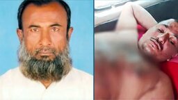 পাঞ্জাবি টেনে ধরায় প্রতিবন্ধীর গায়ে গরম পানি ঢেলে দিলেন আ. লীগ নেতা