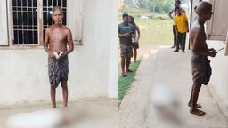 মৃত বোনের সঞ্চয় পেতে ব্যাংকে কঙ্কাল নিয়ে হাজির ভাই