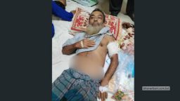 নেশার টাকা না দেওয়ায় বাবাকে কুপিয়ে জখম করলো ছেলে