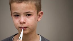 ফরিদপুরে হামের প্রাদুর্ভাব : ৪ মাসে আক্রান্ত ৭২৫, মৃত্যু ৮