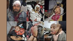 লালমোহনে জামায়াত ও বিএনপি সমর্থকদের মধ্যে সংঘর্ষে আহত ৩০