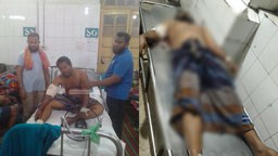 গোপালগঞ্জ সংঘর্ষে গুলিবিদ্ধ রিকশাচালকের মৃত্যু, মৃতের সংখ্যা বেড়ে ৫