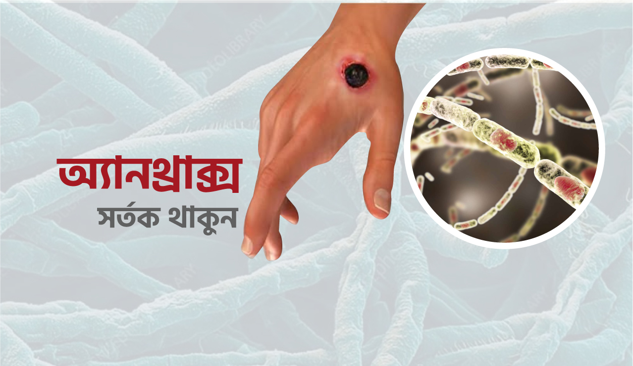 অ্যানথ্রাক্স কী, লক্ষণ ও প্রতিরোধের উপায়