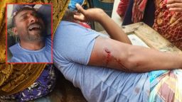 শার্শায় ২০ লক্ষ টাকা চাঁদার দাবিতে যুবককে হাতুড়ি দিয়ে পিটিয়ে জখম