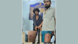 সরাইলে মাদকাসক্ত ব্যক্তির কামড়ে দুই পুলিশ সদস্য আহত, আটক ১