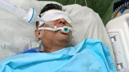 টাকার অভাবে হাসপাতাল ছাড়তে পারছেন না পোশাককর্মী