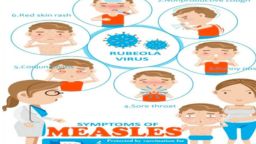 ফরিদপুরে হানা দিয়েছে হাম: দেশ জুড়ে ২১শিশুর মৃত্যু