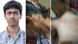 ফেনীতে কিশোর গ্যাংয়ের হামলায় কলেজছাত্র গুরুতর আহত