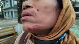 যুব উন্নয়ন কর্মকর্তার বিরুদ্ধে অফিস সহকারীর স্ত্রীকে মারধরের অভিযোগ