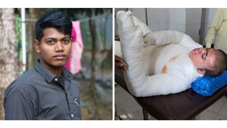 জীবন-মৃত্যুর সন্ধিক্ষণে সজিব: ৯০ ভাগ পোড়া শরীর নিয়ে বাঁচার আকুতি, সাহায্যের আবেদন