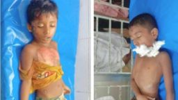 নোয়াখালীতে অটোরিকশা চাপায় দুই শিশু শিক্ষার্থীর মৃত্যু