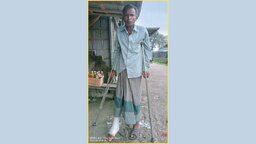 চিকিৎসার অভাবে পঙ্গুত্বের দিকে এগোচ্ছেন নীলফামারীর মানিক