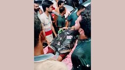 ফরিদপুরে পাইলসের বদলে গলব্লাডার অপারেশন, রোগীর অবস্থা সংকটাপন্ন