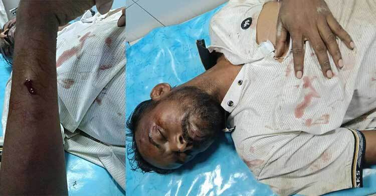 রাজধানীর আফতাবনগরে হিরো আলমের ওপর হামলা, ‘অবস্থা আশঙ্কাজনক’
