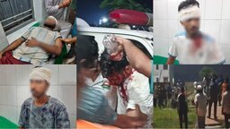 ৪ দফায় সংঘর্ষের জেরে নজরুল বিশ্ববিদ্যালয়ের ৬ শিক্ষার্থী আহত
