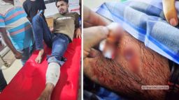 নোয়াখালীতে যুবদল কর্মীর গুলিতে জামায়াতের ২ কর্মী আহত