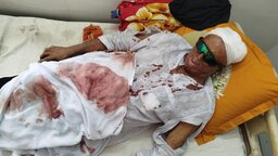 গোপালগঞ্জে সাবেক ইউপি চেয়ারম্যানের ওপর হামলা, আহত ২